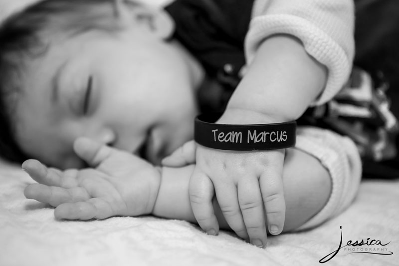 Picture of baby with "Team Marcus" wristband
